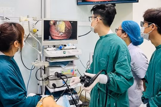 Cẩn trọng khi mắc chứng rối loạn tiêu hóa kèo dài