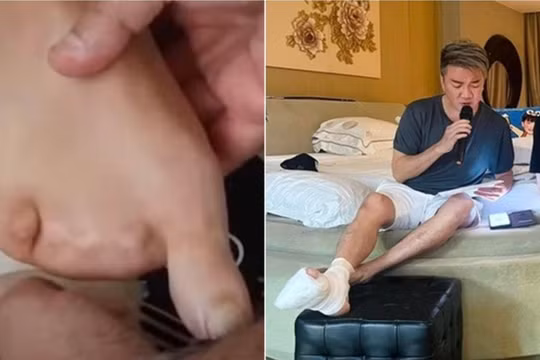 Thông tin ca sĩ Đàm Vĩnh Hưng bị mất 4 ngón chân là sai sự thật