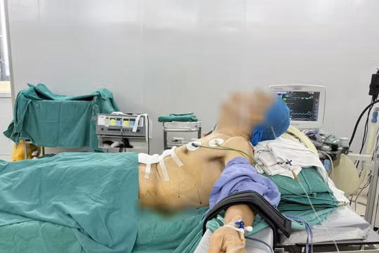 Bác sĩ thực hiện ca mổ ung thư dạ dày cho bệnh nhân “nửa nằm, nửa ngồi” ra sao?