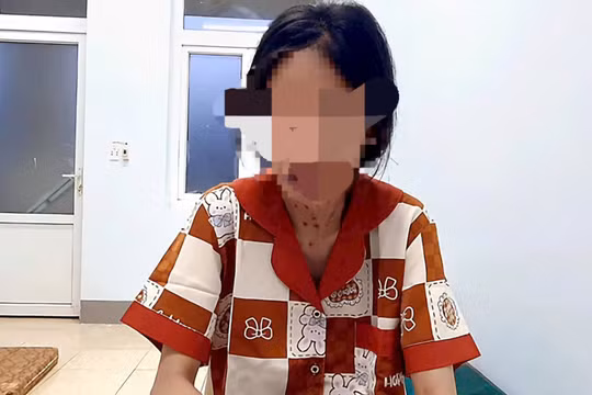 Đắk Lắk: Mâu thuẫn sinh hoạt, vợ dùng dao tấn công chồng