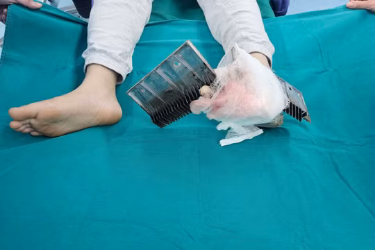 Bị thang cuốn kẹp vào chân, bé trai Hà Nội phải mổ cấp cứu
