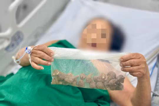 Uống 'thần dược' chữa khớp, bệnh nhân 78 tuổi suýt mất mạng vì ngộ độc củ ấu tầu