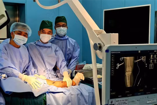Phẫu thuật thành công ca gãy xương phức tạp ngay đặc khu Côn Đảo