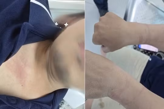 Phóng viên VOV Giao thông bị còng tay khi tác nghiệp tại hiện trường vụ cháy