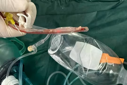 Sau loạt vụ trẻ mất an toàn tại các cơ sở mầm non, ngành giáo dục TP HCM chỉ đạo khẩn