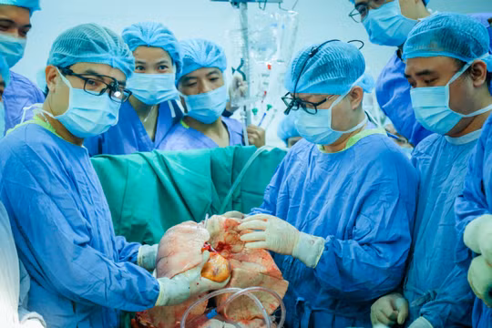 Kỳ tích ghép tim – phổi đầu tiên tại Việt Nam cho người bệnh suy đa tạng