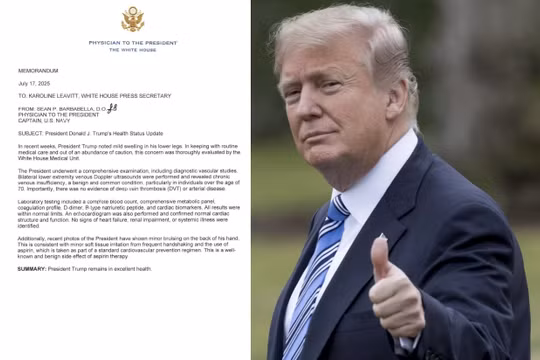 Ông Trump chỉ mắc bệnh tĩnh mạch gây sưng chân, sức khỏe hoàn toàn bình thường