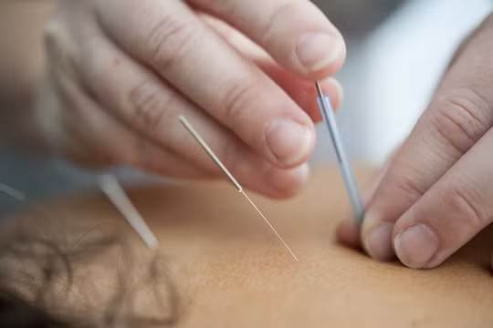 Trung Quốc: Người đàn ông suýt chết vì nhờ 'lang băm' châm cứu chữa khối u