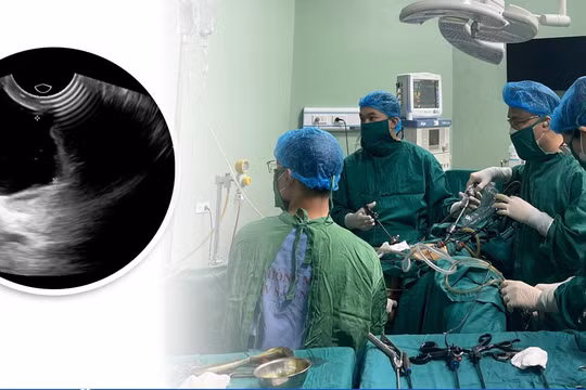Suýt mất khả năng làm mẹ vì khối u hiếm gặp