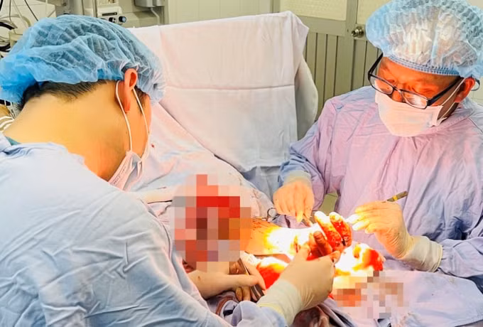Ca mổ nối bàn tay cho anh N.Đ.P. (Ảnh: BVCC)