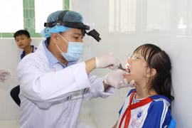 TP HCM thí điểm mô hình tổ lưu động chăm sóc răng miệng cho học sinh