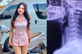 Mối nguy từ liệu pháp massage 'vặn cổ' sau cái chết của ca sĩ trẻ Thái Lan