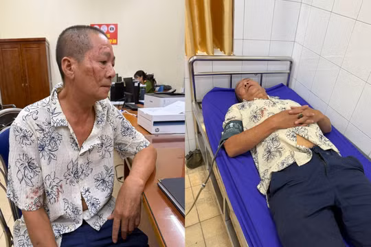 Quảng Ninh: Người đàn ông bị đánh nhập viện vì không có quyền bàn giao bến cảng