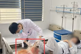 Cẳng chân hoại tử, bốc mùi vì đắp lá chữa bỏng