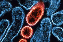 Ấn Độ khẳng định đã kiểm soát được dịch Nipah
