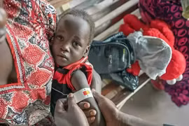 UNICEF: Hơn 450.000 trẻ em ở Nam Sudan có nguy cơ suy dinh dưỡng cấp tính