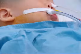 Bé trai 19 tháng tuổi nguy cơ di chứng vì ngộ độc hạt củ đậu