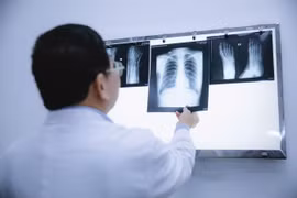 Không in phim chẩn đoán hình ảnh có thể tiết kiệm 1.500 tỷ đồng mỗi năm