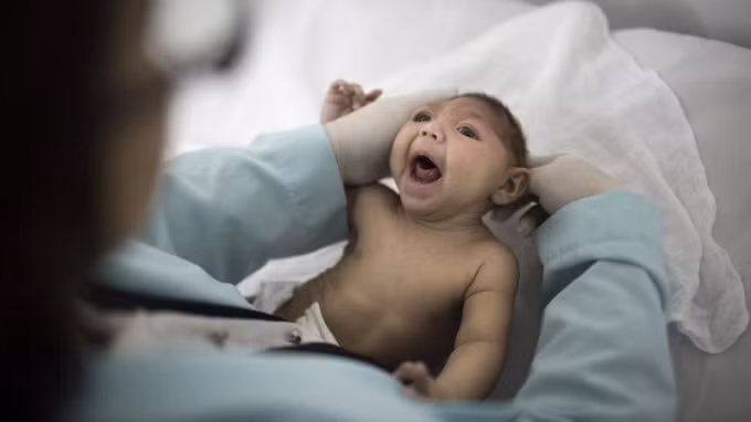 Virus Zika gây bệnh 'ăn não người' khiến dị tật thai nhi. Ảnh: TL