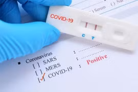 Cách giảm thiểu tình trạng “dương tính giả” khi test nhanh