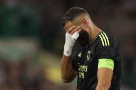Chấn thương của Benzema không quá nghiêm trọng