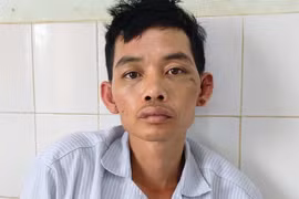 Một thanh niên ở Gia Lai bị đánh nhập viện vì trộm xe máy