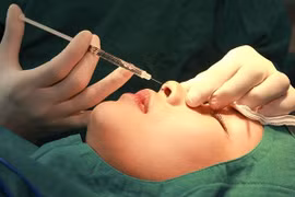 “Sửa tướng đổi vận” theo phong thủy, ẩn họa khôn lường