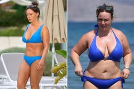 Chanelle Hayes: Bồ cũ của Balotelli và Ronaldo giảm 57kg nhờ phẫu thuật