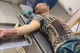 Kon Tum: Gã hàng xóm “bắt sâu” trên ngực vợ rồi chém chồng trọng thương
