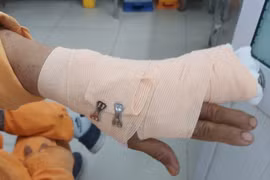Đến nhắc nợ, nhân viên điện lực bị đánh đứt gân tay