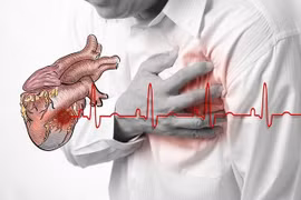 Chế độ ăn uống cho bệnh nhân suy tim