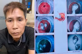 Khống chế đối tượng nuốt ma túy định tẩu thoát