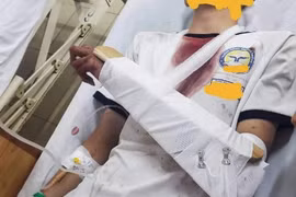 TP. HCM: Khẩn trương làm rõ vụ nam sinh bị chém