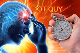 Đột quỵ do chảy máu não ở Việt Nam cao hơn thế giới, bệnh nhân ngày càng trẻ hóa