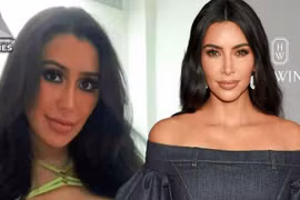 Cô gái Hàn Quốc trải qua 15 ca phẫu thuật để được như Kim Kardashian