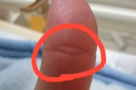 Người sở hữu vân mắt Phật trên ngón tay cái có vận mệnh như thế nào?