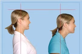 Mất cân bằng thể dáng: 3 hội chứng phổ biến bác sỹ cảnh báo không nên làm