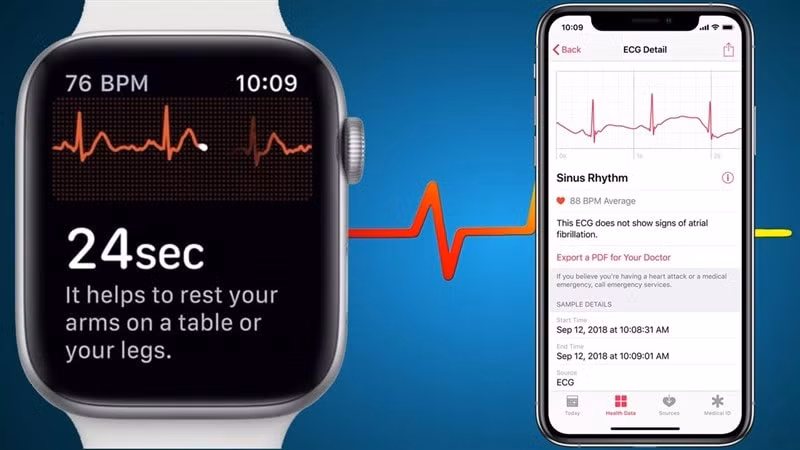 Tính năng đo điện tâm đồ trên Apple Watch bị giới hạn sử dụng tại Mỹ.