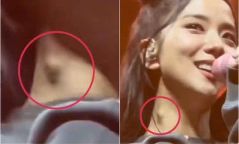 bac si han quoc khuyen jisoo blackpink nen di kham som hinh 1
