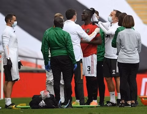 Cầu thủ Bailly gặp chấn thương vùng đầu trong trận Bán kết FA Cup 2019/20 với Chelsea. Ảnh: internet.