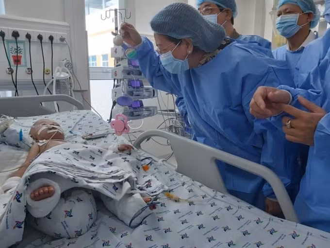 Phó Chủ tịch nước đến thăm cặp song sinh Trúc Nhi - Diệu Nhi trong phòng hồi sức. Ảnh: TL.