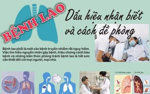 tang cuong tuyen truyen ve ganh nang benh lao va cong tac phong chong benh lao hinh 1