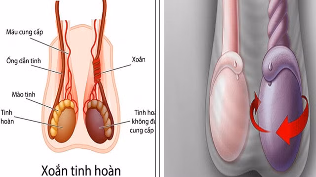 phu tho nam thanh nien hong cua quy do den vien muon hinh 1