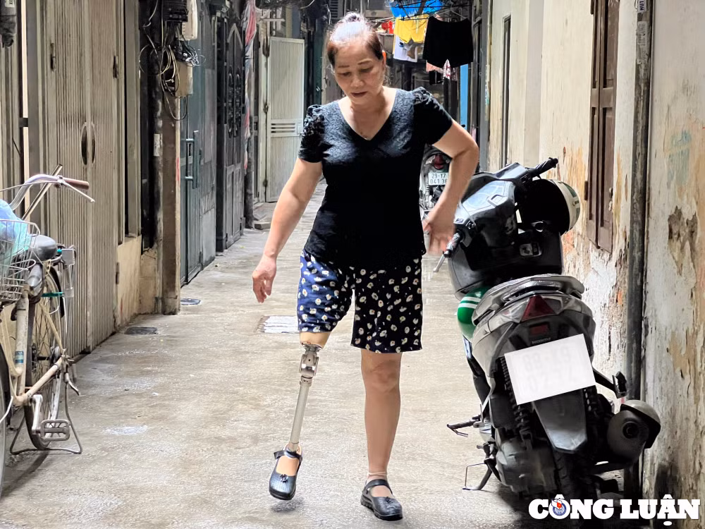 xuong san xuat chan tay gia mien phi cho nguoi khuyet tat hinh 5
