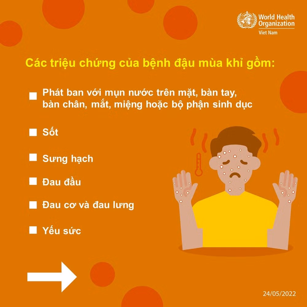 infographic nhung dieu can biet ve benh dau mua khi hinh 3
