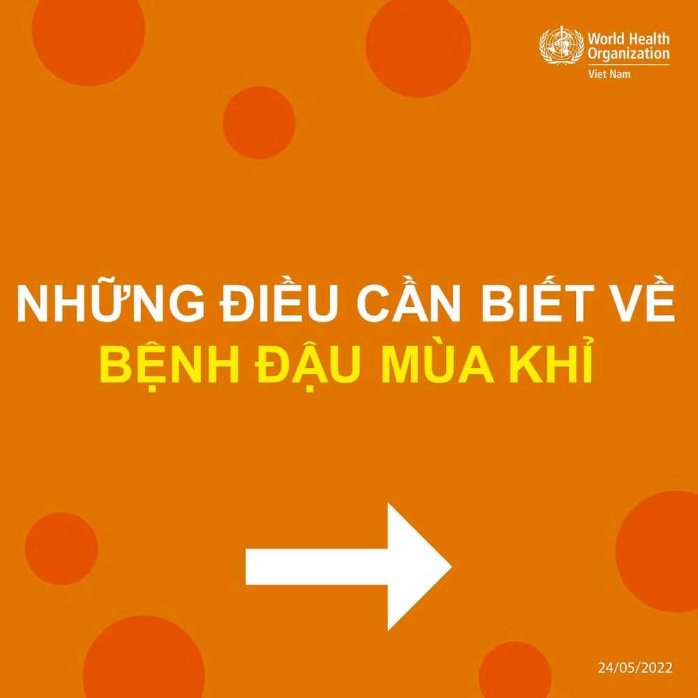 infographic nhung dieu can biet ve benh dau mua khi hinh 1