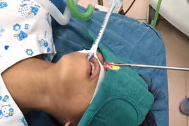 Uống thuốc còn cả vỏ, bé trai 10 tuổi ở Đồng Nai phải nhập viện cấp cứu