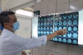 6 người nhiễm độc thiếc ở Hải Dương: Trường hợp nặng bị tâm thần, tử vong
