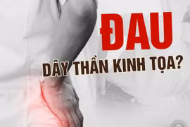 Những dấu hiệu nhận biết cơn đau thần kinh tọa