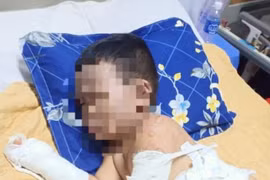 Bắt giữ 4 nghi can trong vụ ném bom xăng làm 2 cháu bé bỏng nặng